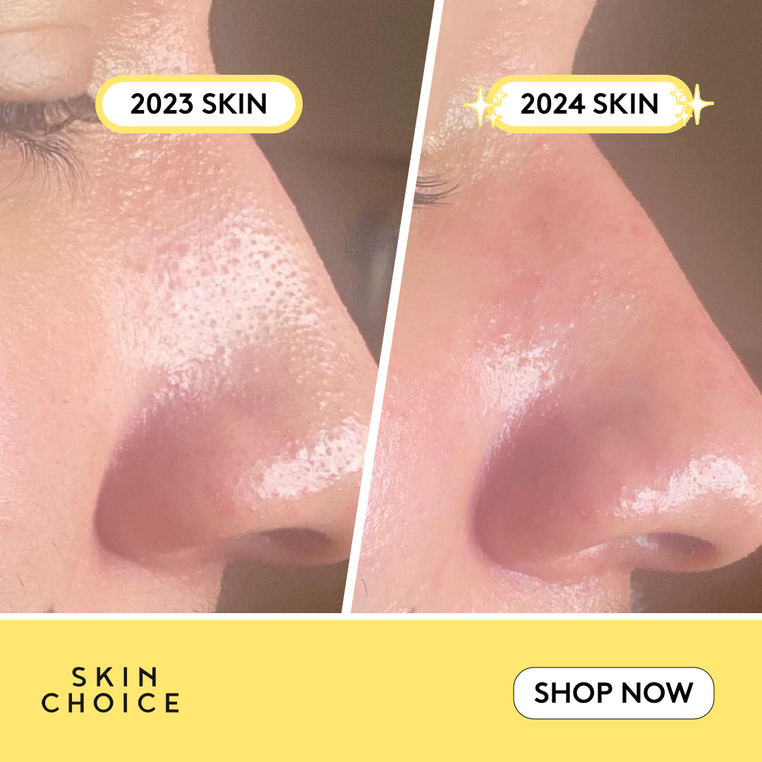 Nose Pore Patches-2